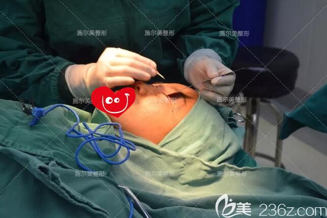 常州施爾美醫(yī)生做雙眼皮手術(shù)中