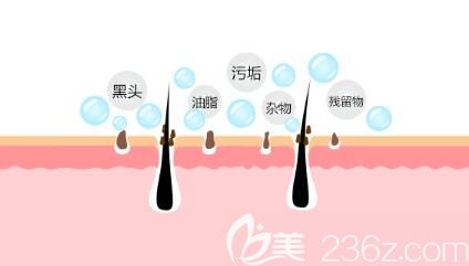 毛孔粗大形成的原因介紹