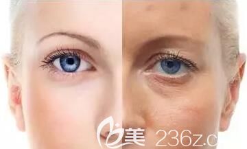 抗衰老一直都是女人所關(guān)注的話題