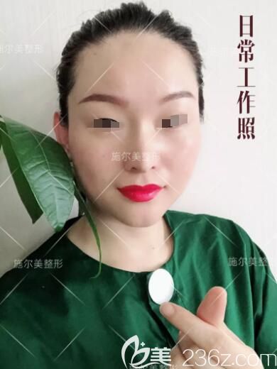 無錫施爾美真人效果圖：微針美膚術(shù)后七天日記公開 還有孫華醫(yī)生分享術(shù)后詳細護理事項