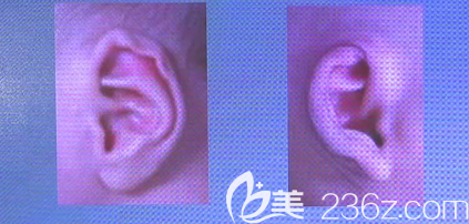 卷耳案例 卷耳案例