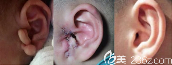 多耳案例 多耳案例