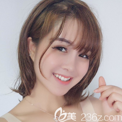 東莞華美詹慧做的鼻綜合隆鼻子案例 東莞華美詹慧做的鼻綜合隆鼻子案例
