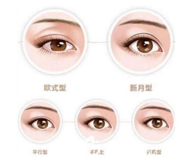 常見雙眼皮的幾種形狀