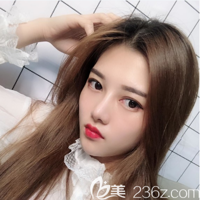 我和閨蜜的肋軟骨隆鼻手術(shù)都是找東莞韓美李陽(yáng)院長(zhǎng)做的,大家看效果怎么樣