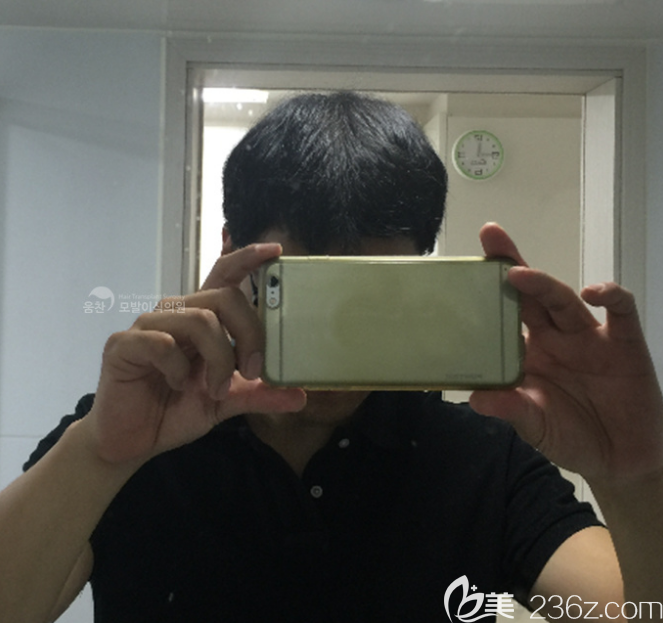 韓國永長玄尚潤做毛發(fā)移植怎么樣 韓國永長玄尚潤做毛發(fā)移植怎么樣