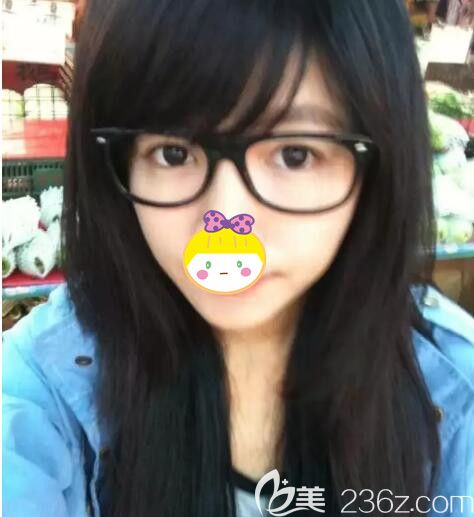 面診無錫坤如瑪麗想要注射豐臥蠶 面診無錫坤如瑪麗想要注射豐臥蠶