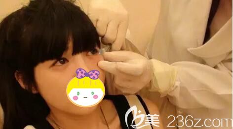 無錫坤如瑪麗醫(yī)生注射豐臥蠶過程中 無錫坤如瑪麗醫(yī)生注射豐臥蠶過程中