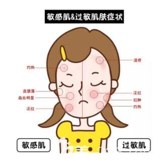 敏感肌與過敏肌的區(qū)別