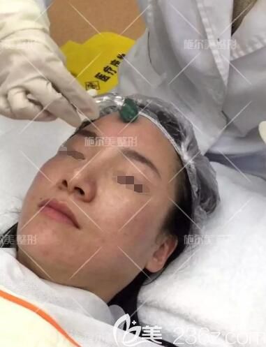 常州施爾美醫(yī)生做微針美塑過(guò)程中 常州施爾美醫(yī)生做微針美塑過(guò)程中