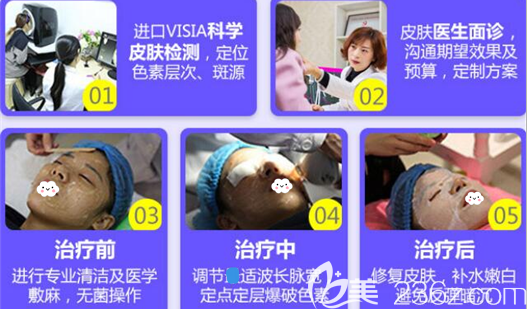 成美整形美容醫(yī)院祛斑治療過程