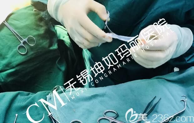 李偉醫(yī)生雕刻硅膠假體 李偉醫(yī)生雕刻硅膠假體