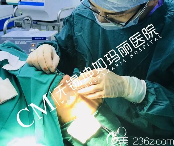 雕刻好的硅膠假體植入鼻中 雕刻好的硅膠假體植入鼻中