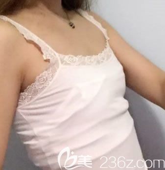 我在玉林時光整形醫(yī)院做隆胸前的照片 我在玉林時光整形醫(yī)院做隆胸前的照片