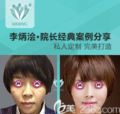 北京美憬李炳澮醫(yī)生肋軟骨鼻綜合隆鼻案例 北京美憬李炳澮醫(yī)生肋軟骨鼻綜合隆鼻案例