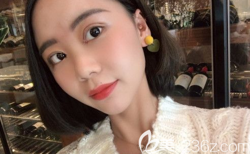 盧相勛雙眼皮做的怎么樣 盧相勛雙眼皮做的怎么樣