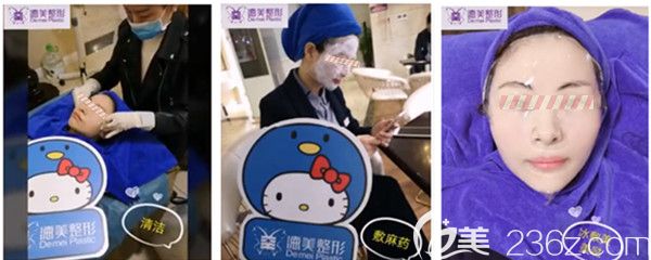 DNA童顏針注射過(guò)程圖