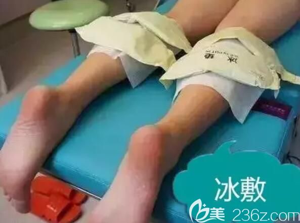 瘦臉除皺瘦腿術(shù)后需要冰敷 瘦臉除皺瘦腿術(shù)后需要冰敷
