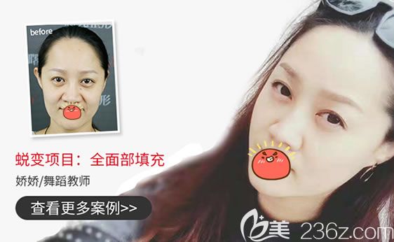 嘉興曙光自體脂肪填充<span style= 嘉興曙光自體脂肪填充<span style=