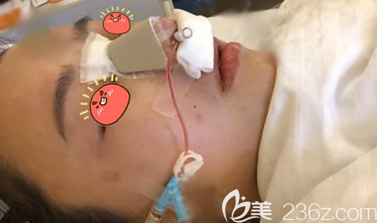 義烏連天美隆鼻<span style=