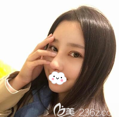 <i data-id='80057854-710c-4b8d-856f-9faaf1974202' style='display:none;'></i>文科隆鼻拆線后效果