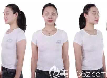 產(chǎn)后哺乳后胸部很平有些下垂 產(chǎn)后哺乳后胸部很平有些下垂