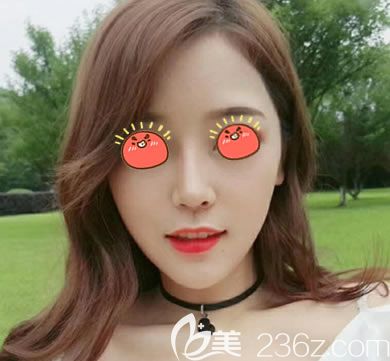 義烏連天美隆鼻<span style= 義烏連天美隆鼻<span style=