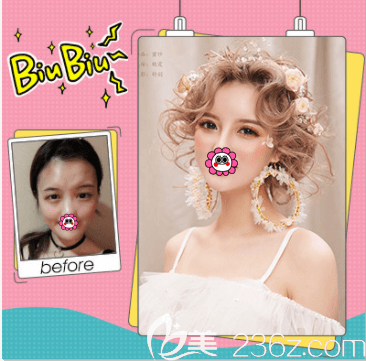 北京壹加壹張綠峰醫(yī)生玖度魅眼案例