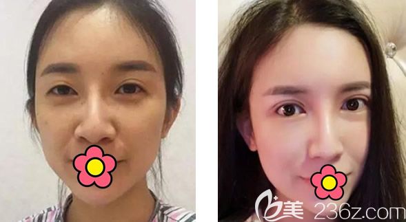 蘭州時(shí)光相伴張曉萍修復(fù)眼睛怎么樣