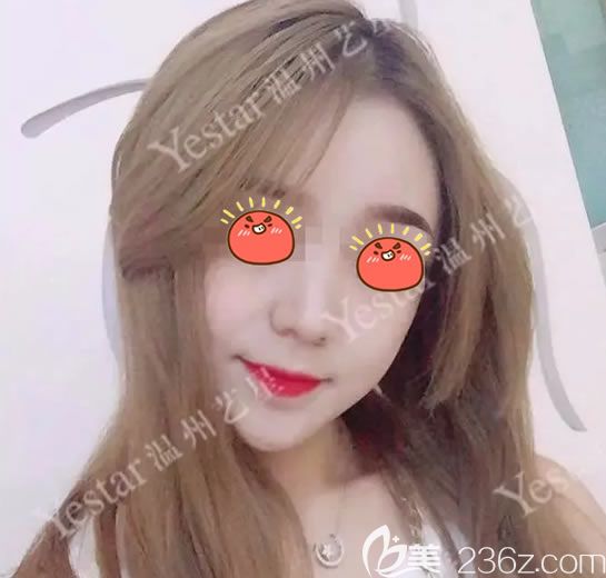 找了溫州藝星這家治痘祛痘坑痘印比較好的醫(yī)院做了激光祛痘套餐,從此不再做口罩女