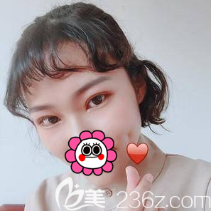 北京美萊葉宇醫(yī)生全切雙眼皮案例 北京美萊葉宇醫(yī)生全切雙眼皮案例