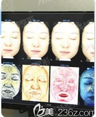 檢測出來的面部斑點問題