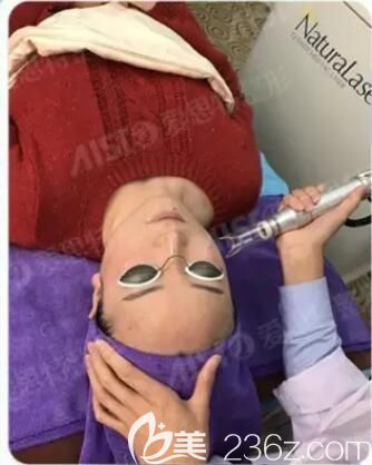 同事在無(wú)錫愛(ài)思特的祛斑效果打破我的疑慮，預(yù)約范紅梅醫(yī)生做了VISIA皮膚檢測(cè)后體驗(yàn)大Q祛斑效果