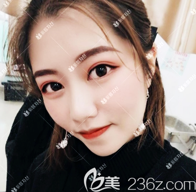 廣州紫馨李石峰做雙眼皮怎么樣 廣州紫馨李石峰做雙眼皮怎么樣