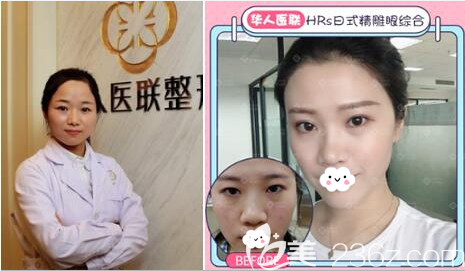 <!--<i data=20240703-sp></i>--><!--<i data=20240703-sp></i>-->雙眼皮<span style=