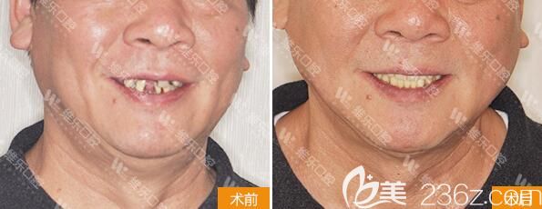 青島維樂(lè)口腔種植牙<span style=