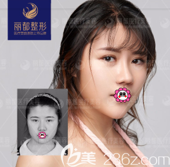 北京米蘭柏羽麗都曹衛(wèi)華眼修復(fù)案例