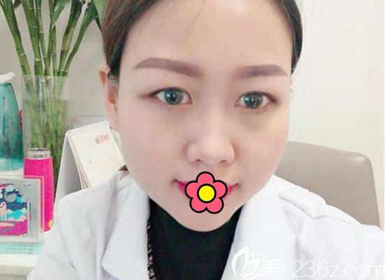 蘭州韓美整形陳誠給我做了蜂巢皮秒激光祛斑后 皮膚白了也緊致了