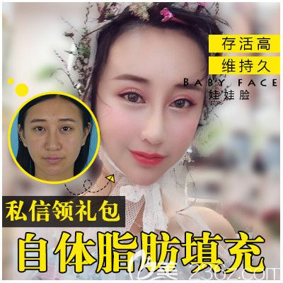 深圳德漾梁志生醫(yī)生脂肪填充案例 深圳德漾梁志生醫(yī)生脂肪填充案例