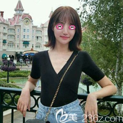 假體隆胸前的照片 假體隆胸前的照片