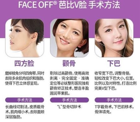 韓國必嫵面部輪廓五件套手術(shù)過程 韓國必嫵面部輪廓五件套手術(shù)過程