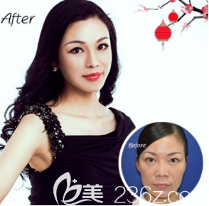 煙臺(tái)鵬愛(ài)醫(yī)院線雕提升案例