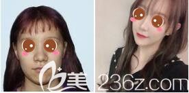 <!--<i data=20240703-sp></i>-->愉悅美聯(lián)臣隆鼻真人