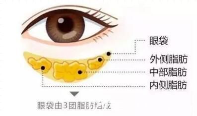 眼袋的組成介紹