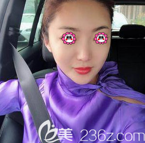 北京美萊劉崇醫(yī)生超皮秒祛斑案例 北京美萊劉崇醫(yī)生超皮秒祛斑案例