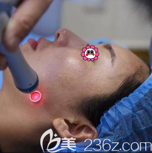 劉崇醫(yī)生給我做超皮秒祛斑當(dāng)天照 劉崇醫(yī)生給我做超皮秒祛斑當(dāng)天照