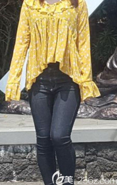 術(shù)前 術(shù)前