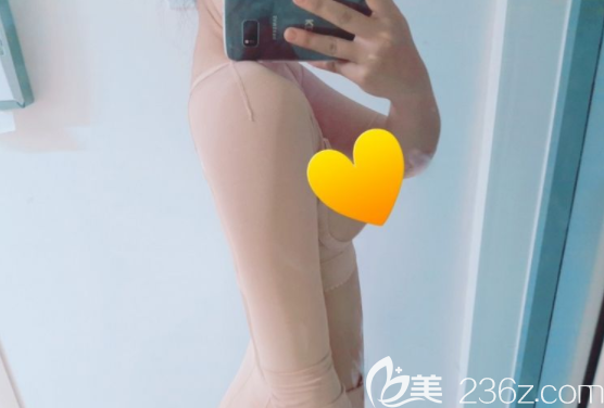 維摩整形外科吸脂怎么樣 維摩整形外科吸脂怎么樣