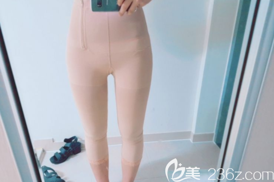 維摩整形外科吸脂案例 維摩整形外科吸脂案例