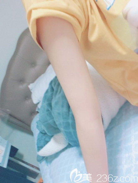 姜在九吸脂費(fèi)用 姜在九吸脂費(fèi)用